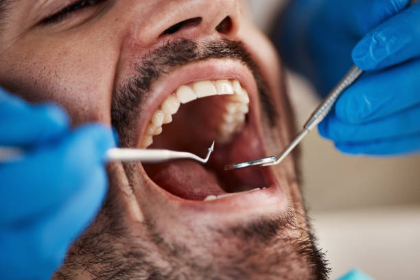 Best Teeth Whitening  in Vinco, PA